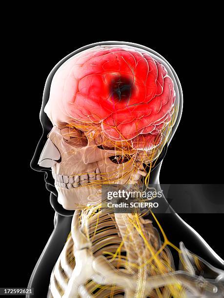 stroke, artwork - schlaganfall stock-grafiken, -clipart, -cartoons und -symbole