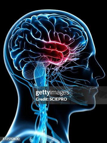 Headache, artwork Headache, artwork