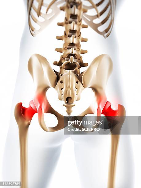 Coxit 135 Coccyx Pain Stock Photos, High-Res Pictures, and Images - Getty Images