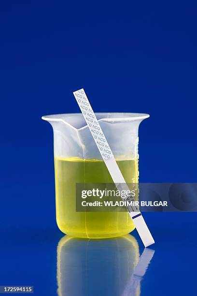 urine test - blood urine stock pictures, royalty-free photos & images