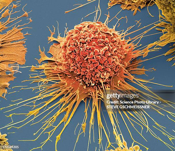 activated macrophage, sem - macrofago foto e immagini stock