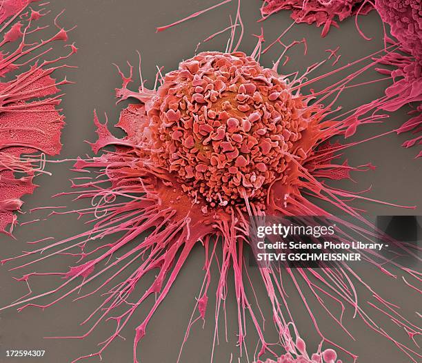 activated macrophage, sem - macrofago foto e immagini stock