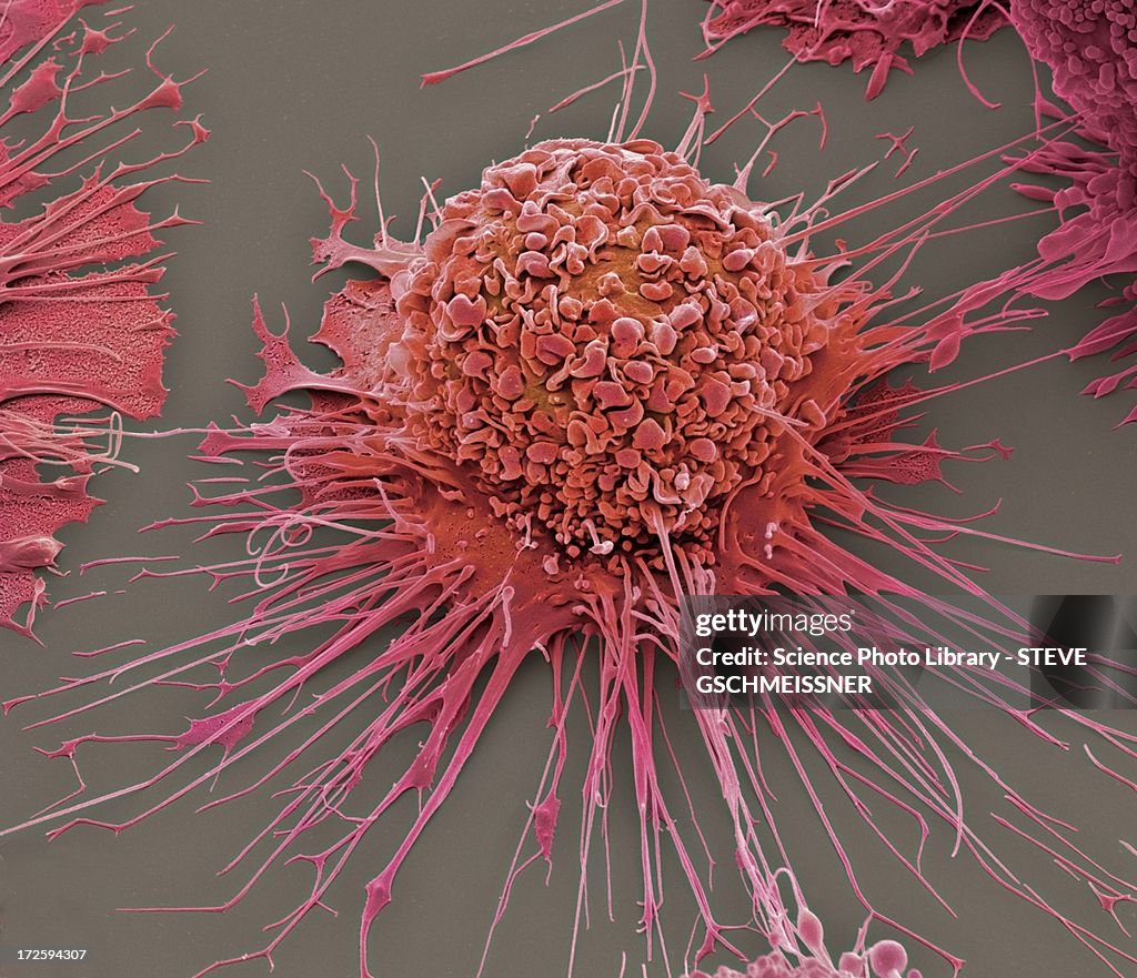 Activated macrophage, SEM