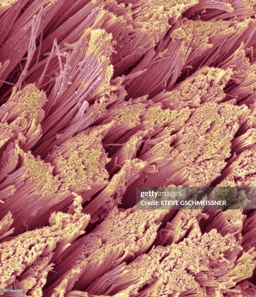 Fractured tendon, SEM