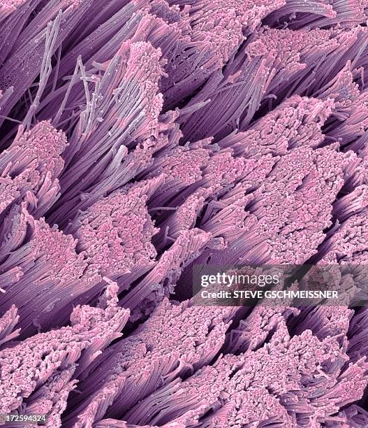 fractured tendon, sem - vue au microscope électronique à balayage en réflexion photos et images de collection