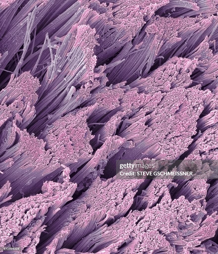 Fractured tendon, SEM
