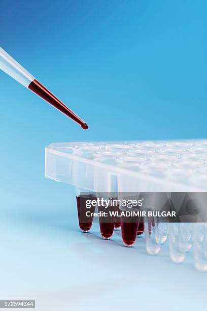 Clean Microtubes 53 Microtubes Stock Photos, High-Res Pictures, and Images - Getty Images
