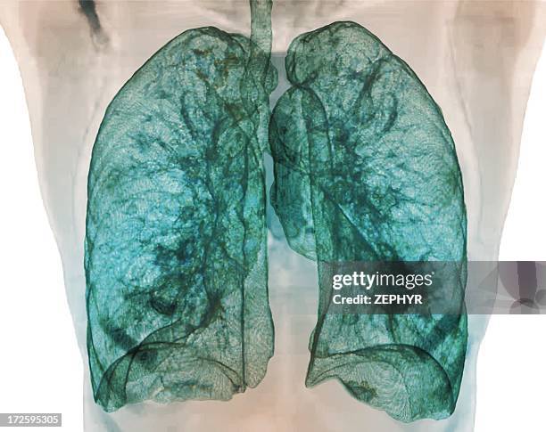 healthy lungs, 3d ct scan - lungs stock pictures, royalty-free photos & images