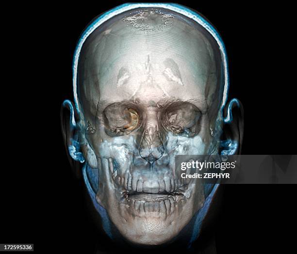human head, 3d ct scan - scientific imaging technique stock pictures, royalty-free photos & images