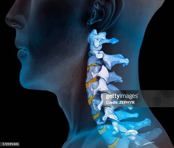 normal neck bones, 3d ct scan - wissenschaftliche bildtechnik stock-fotos und bilder