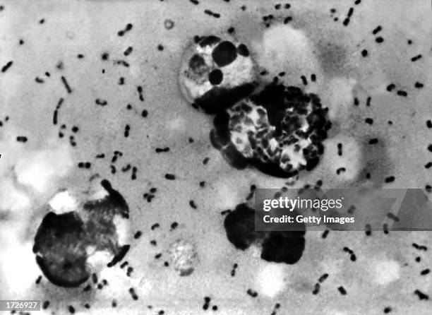 Bubonic plague smear, prepared from a lymph removed from an adenopathic lymph node, or bubo, of a plague patient, demonstrates the presence of the...