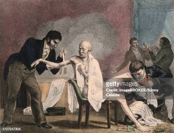 illustrazioni stock, clip art, cartoni animati e icone di tendenza di an emaciated old man being treated by four doctors, 1852, a steam bath billows in the background. the two men on the far right hold a glass eye and a pair of false teeth, france, historic, digitally restored reproduction of an original of the period - occhio di vetro