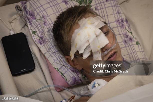 Year-old Ukrainian soldier, Ivan suffering from an amputated leg, shrapnel wounds to his face and arm after being hit by a grenade from an FPV drone,...