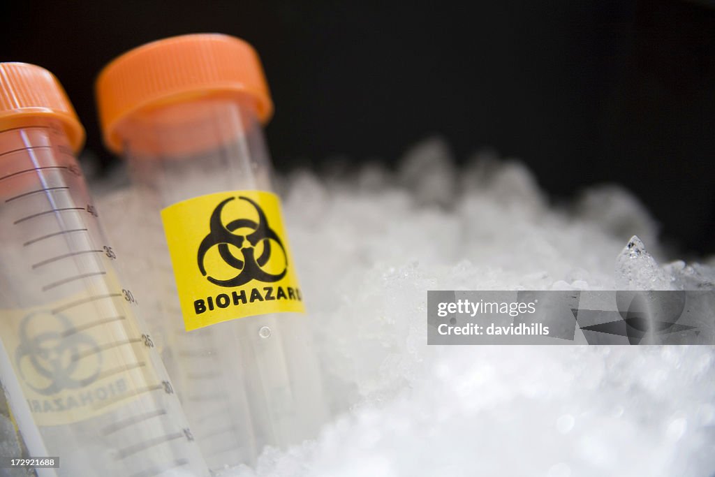 Biohazard samples.