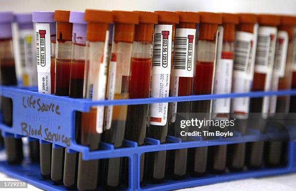 Lifesource Test Lifesource Photos and Premium High Res Pictures - Getty Images