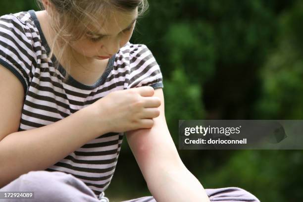big mosquito bite - child bug bite stock pictures, royalty-free photos & images