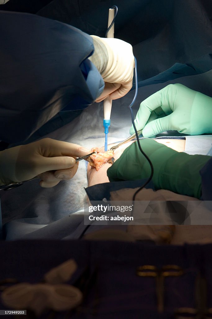 Breast Surgery