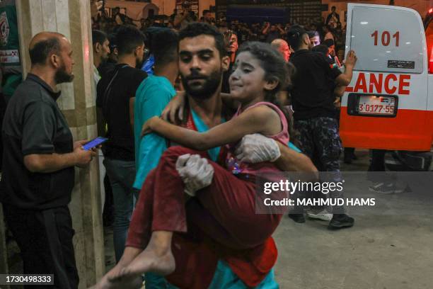 Graphic content / A Palestinian child injured in an Israeli air strike is carried inside the Nasser hospital in Khan Yunis in the southern of Gaza...