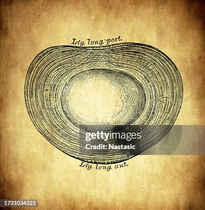 Intervertebral disc Intervertebral disc