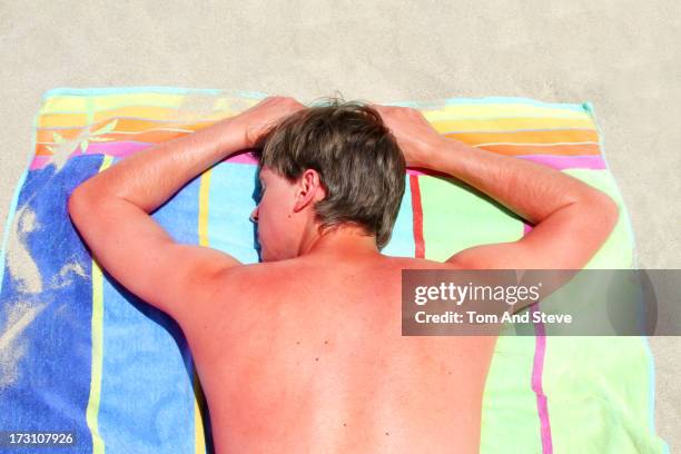 sunburnt adult male lies face down on beach towel - beach sunbathing spain fotografías e imágenes de stock