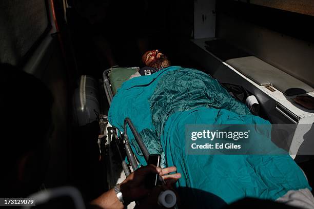 The body of a man lies on a stretcher at the Liltaqmeen al-Sahy Hospital in Cairo's Nasr City district, after allegedly being killed during a...