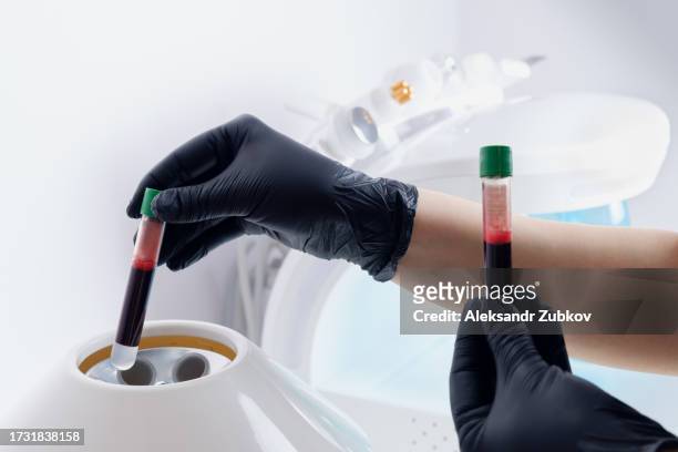 a female cosmetologist or a medical worker puts or puts a test tube with blood in a centrifuge to separate plasma from blood. the concept of aesthetic medicine and cosmetology. plasmolifting and plasma therapy. rejuvenation method and autoplasmotherapy. - fences screening stock-fotos und bilder