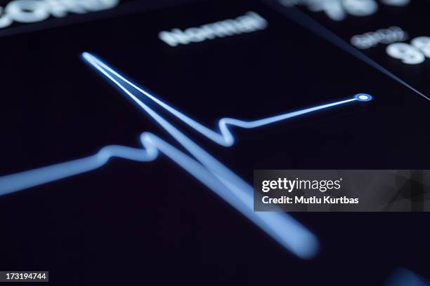 close up of a heartbeat on a machine - pulse trace stockfoto's en -beelden