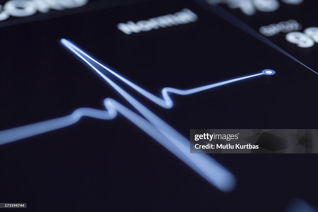 Close up of a heartbeat on a machine
