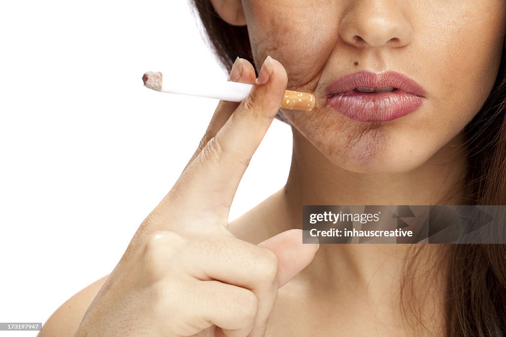 The effects of smoking (Area on Face is Aged)