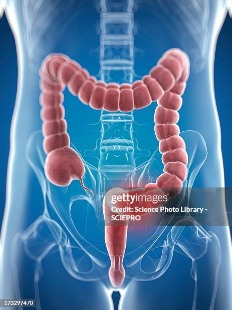 stockillustraties, clipart, cartoons en iconen met colon cancer, artwork - middelste deel