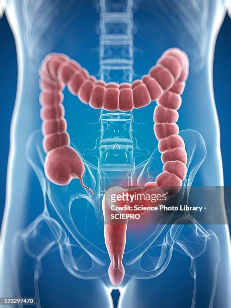 colon cancer, artwork - mid section stock illustrations
