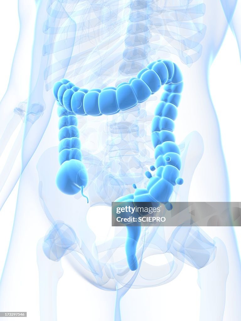 Diverticulosis, artwork