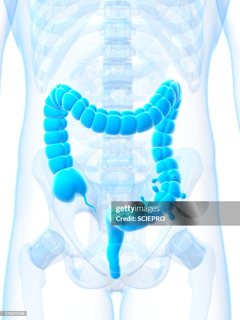 Diverticulosis, artwork