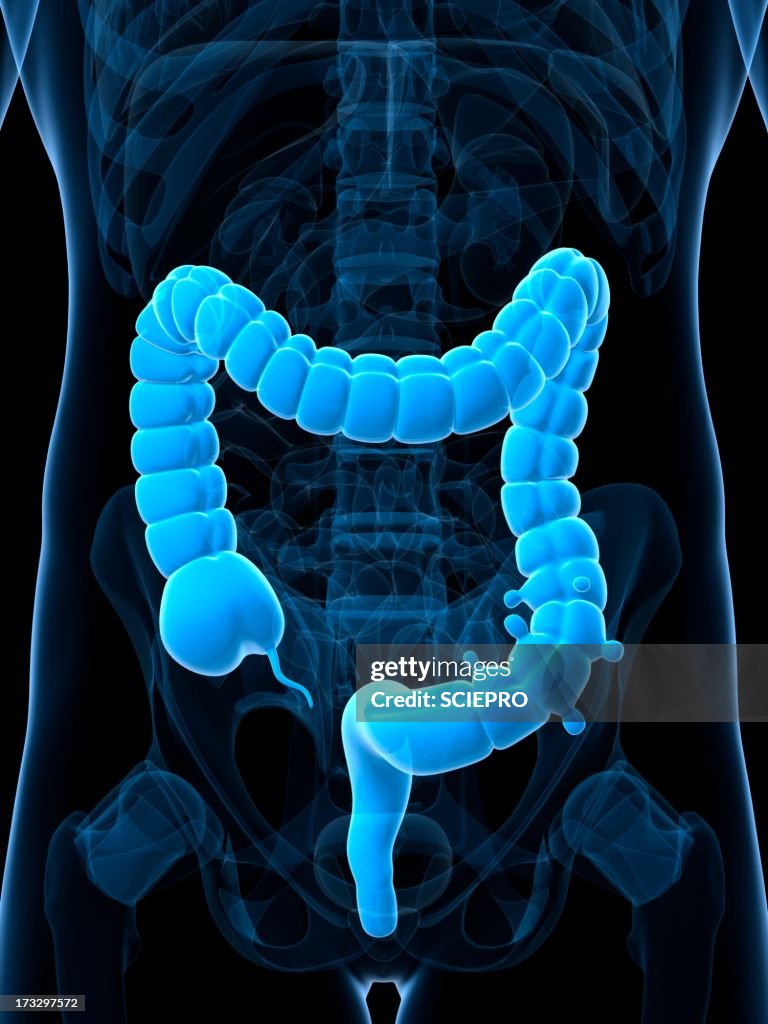 Diverticulosis, artwork