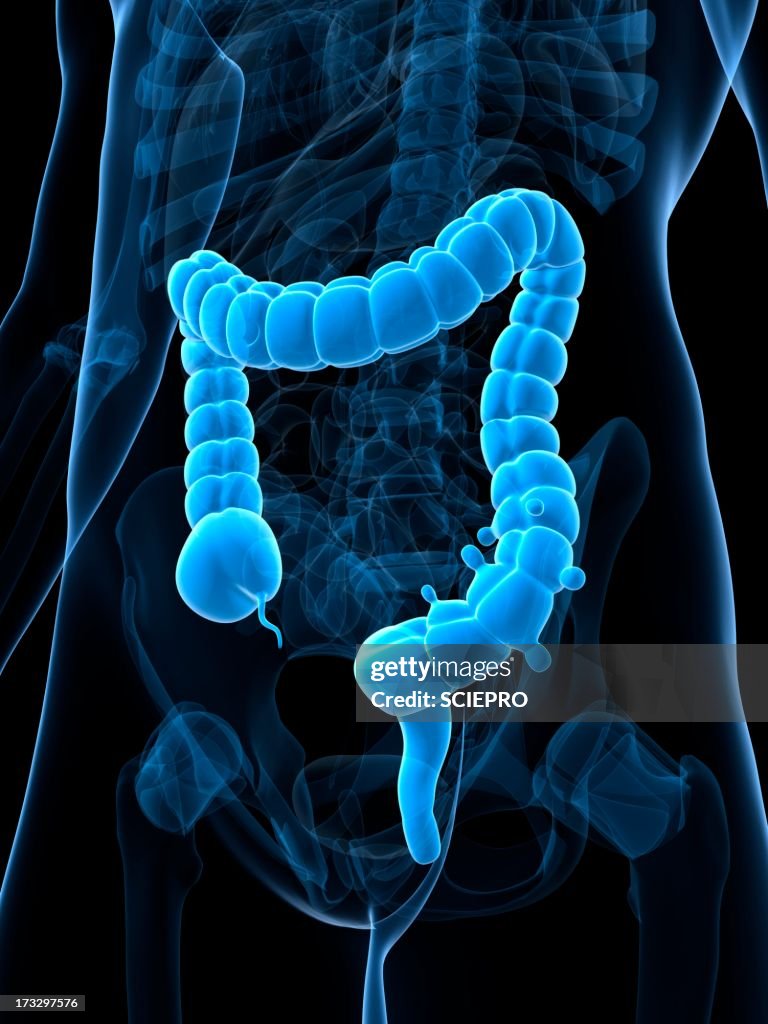 Diverticulosis, artwork