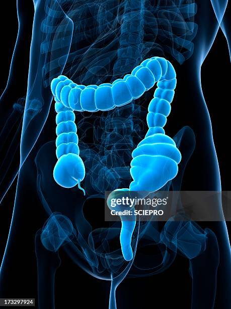 constipated colon, artwork - constipation stock illustrations