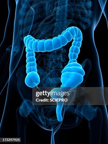 Constipated colon, artwork Constipated colon, artwork