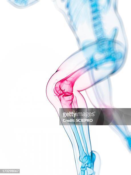 ilustraciones, imágenes clip art, dibujos animados e iconos de stock de knee pain, conceptual artwork - knee