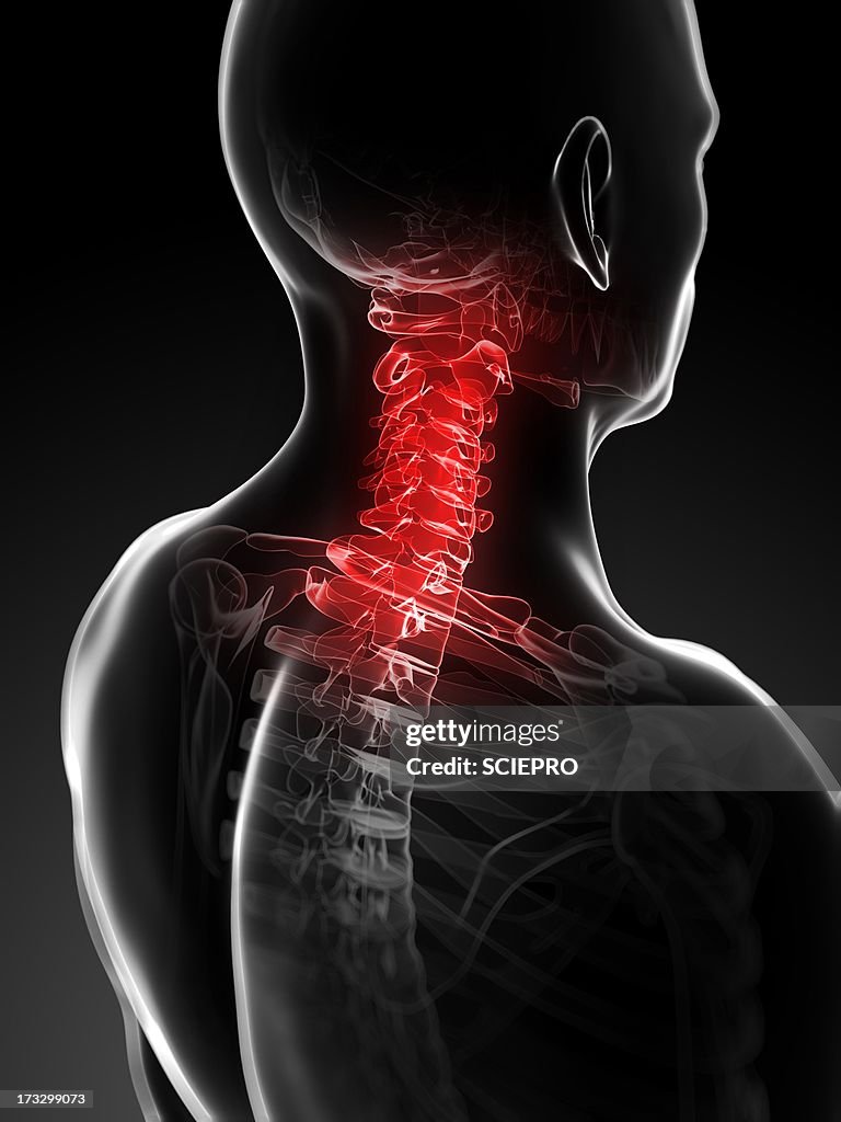 Neck pain, conceptual artwork