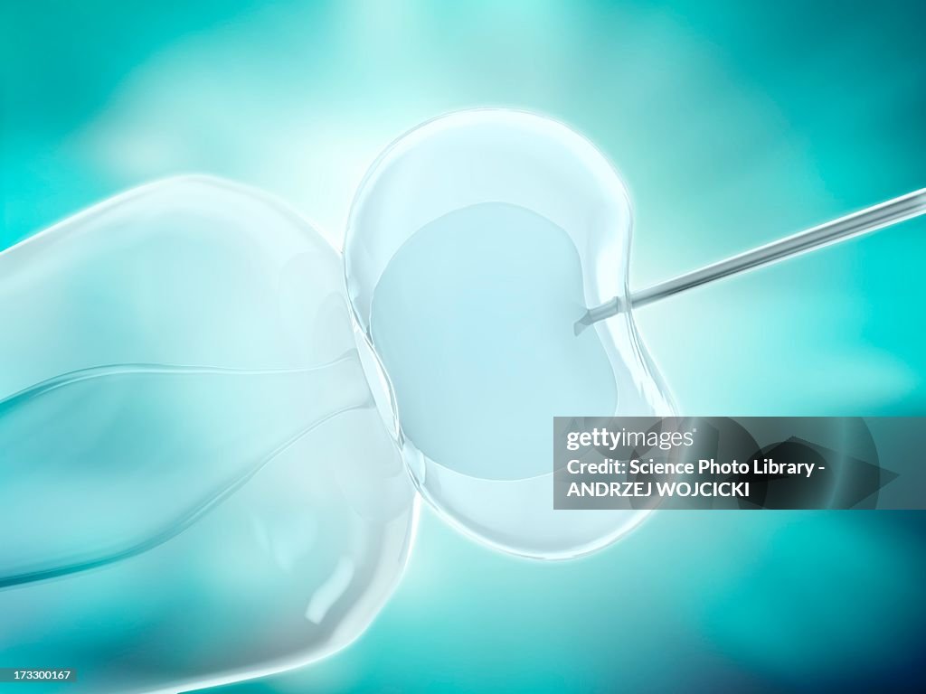 In vitro fertilisation, artwork