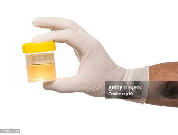 muestra de orina - urine sample fotografías e imágenes de stock