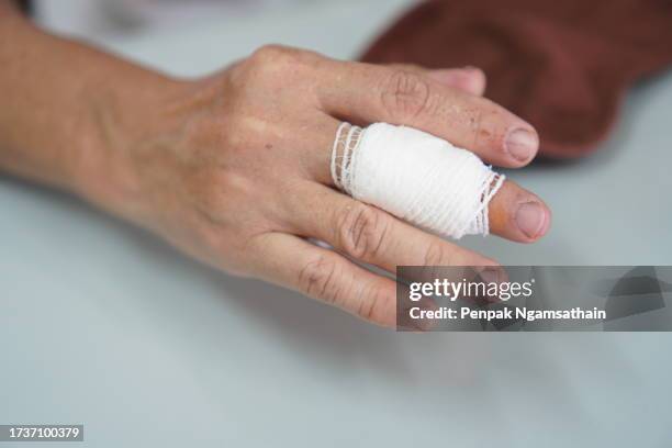 woman hand wraps bandage on middle finger - broken finger ストックフォトと画像