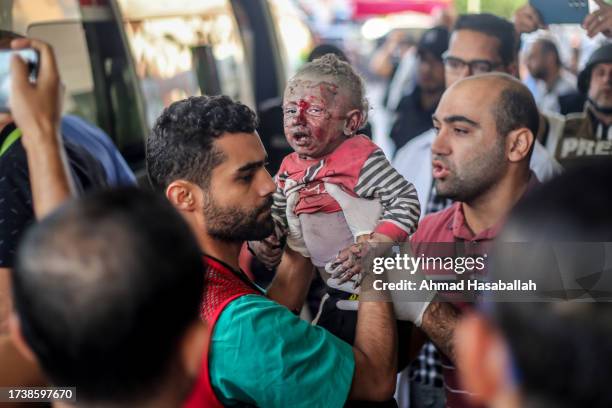 Palestinian children injured during Israeli air raids in the southern Gaza Strip arrive on October 16, 2023 in Khan Yunis, Gaza. Gazans are...