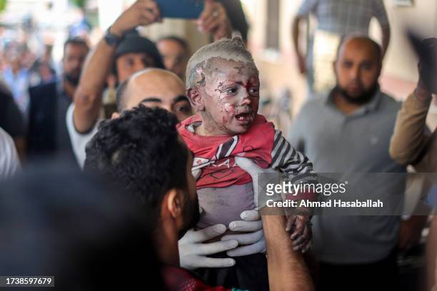 Palestinian children injured during Israeli air raids in the southern Gaza Strip arrive on October 16, 2023 in Khan Yunis, Gaza. Gazans are...