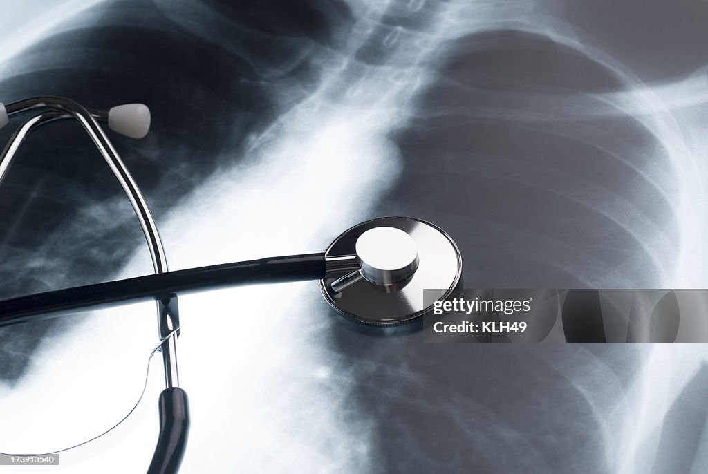 Stethoscope and Chest XRay