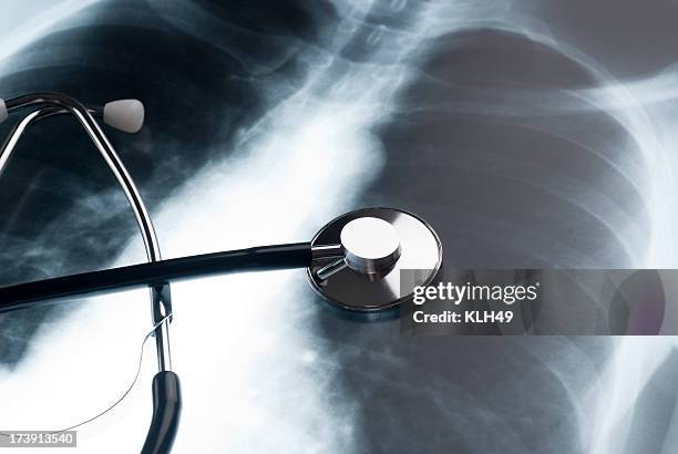 stethoscope and chest xray - long term stockfoto's en -beelden