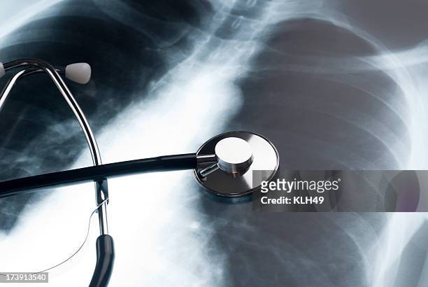 stethoscope and chest xray - human lung stock pictures, royalty-free photos & images