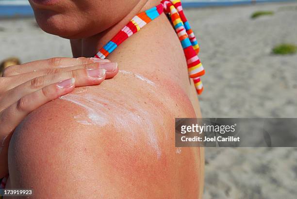 sonnencreme auftragen - sunburn stock-fotos und bilder