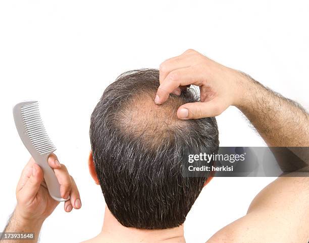 parcialmente calvo - calvo fotografías e imágenes de stock