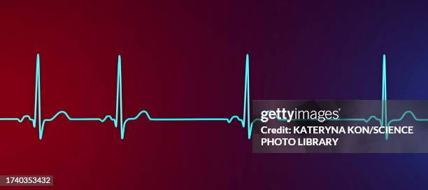 sinus arrhythmia heartbeat rhythm, illustration - track record stock illustrations
